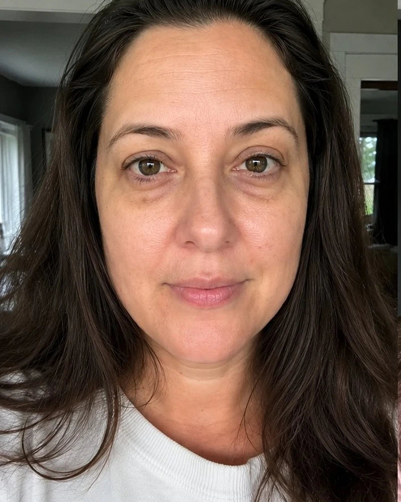 Visage avant drainage lymphatique facial — teint terne, poches sous les yeux